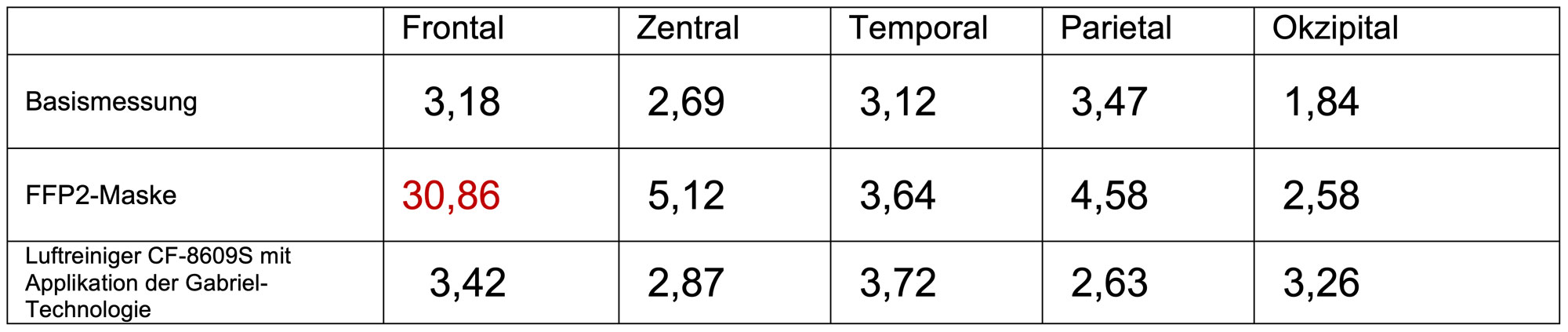 Tabelle 1. Mittlere Leistungsdichten in µV2/Hz der EEG-Aktivierungen im Theta-Band