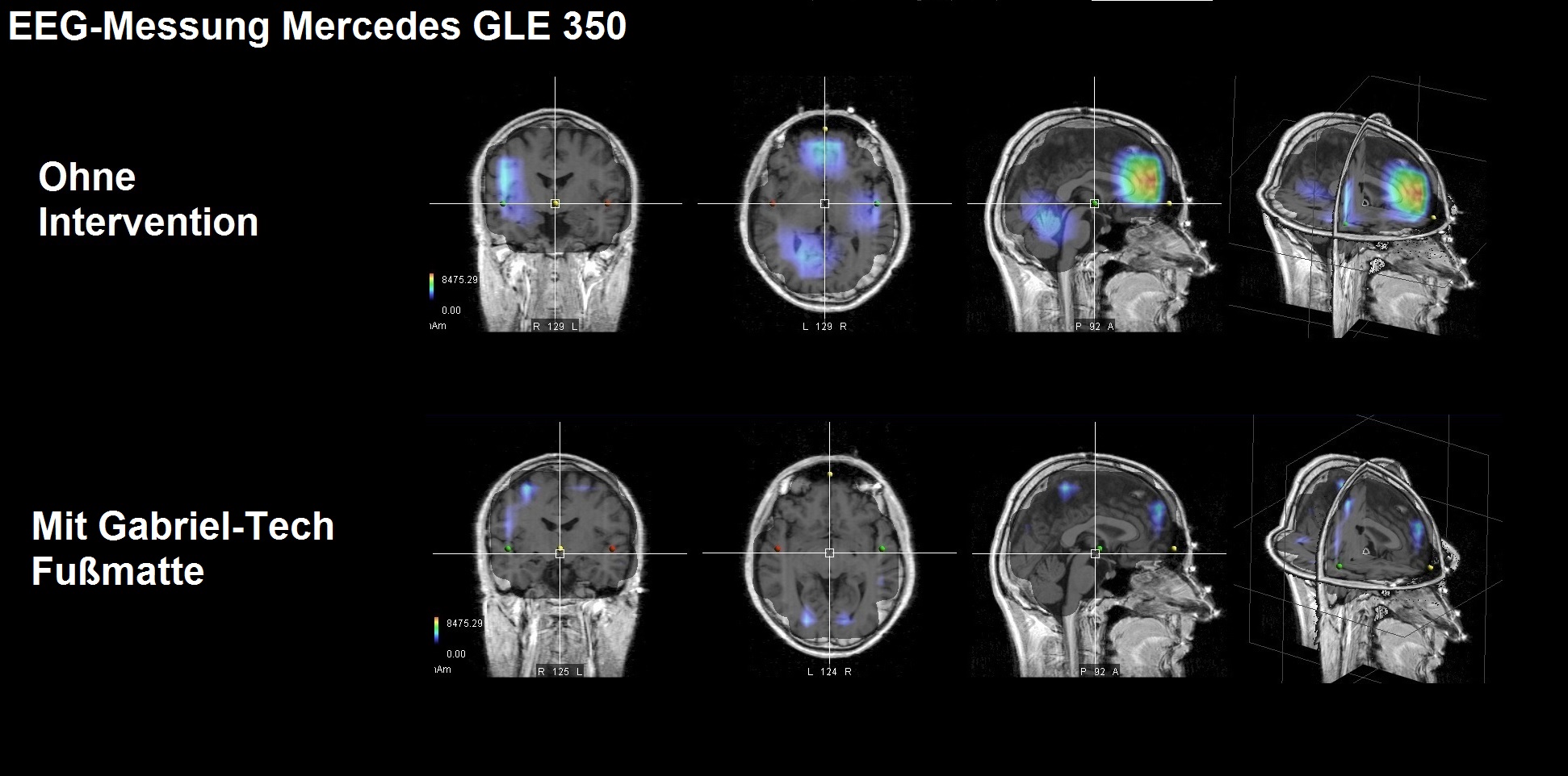 EEG-Messung KfZ Gabriel-Technologoe-Fußmatte