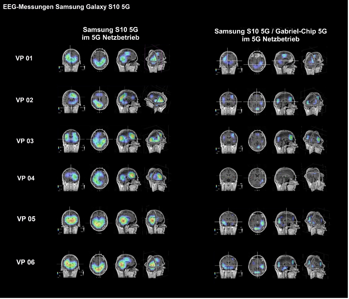 EEG-Testmessungen Samsung Galaxy S10 5G mit der Gabriel-Technologie – Abbildung 1
