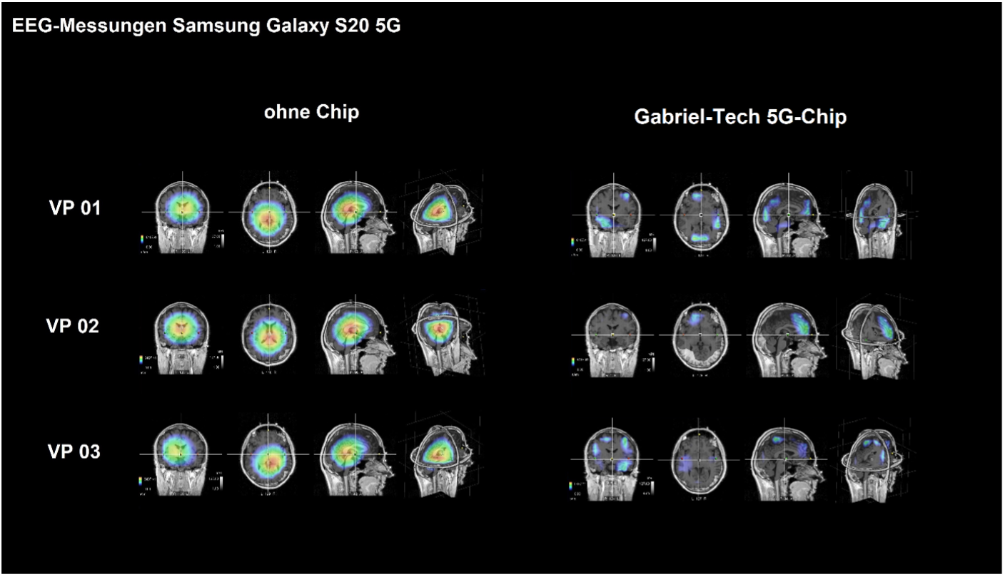 EEG-Testmessungen Samsung Galaxy S20 5G mit der Gabriel-Technologie – Abbildung 1