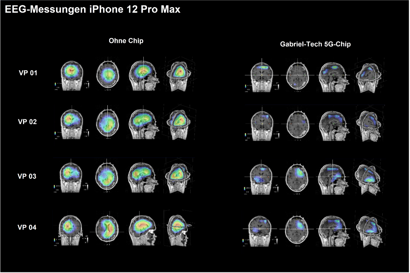 EEG-Testmessungen iPhone 12 Pro Max 5G mit der Gabriel-Technologie – Abbildung 1