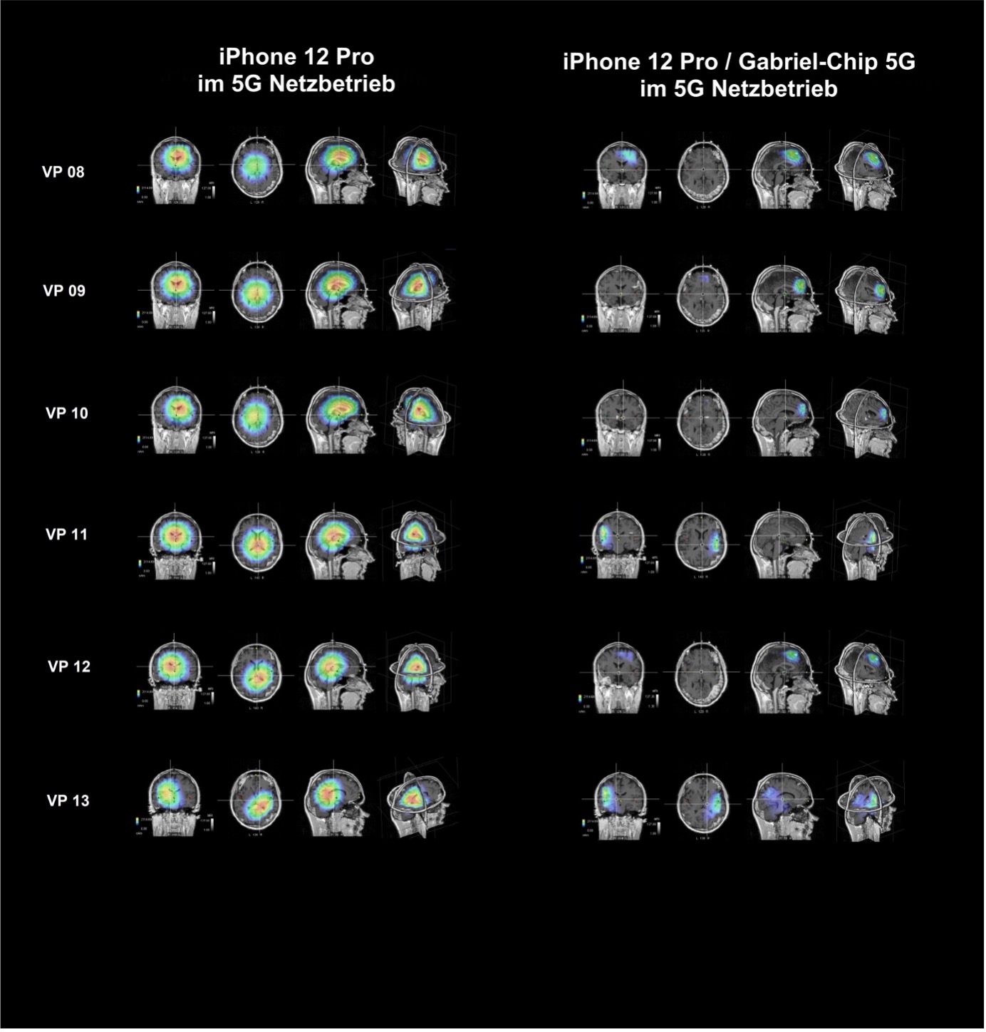 EEG-Testmessungen iPhone 12 Pro 5G mit der Gabriel-Technologie – Abbildung 2