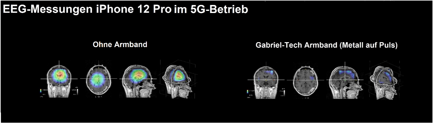 Messung Gabriel-Frequenzband