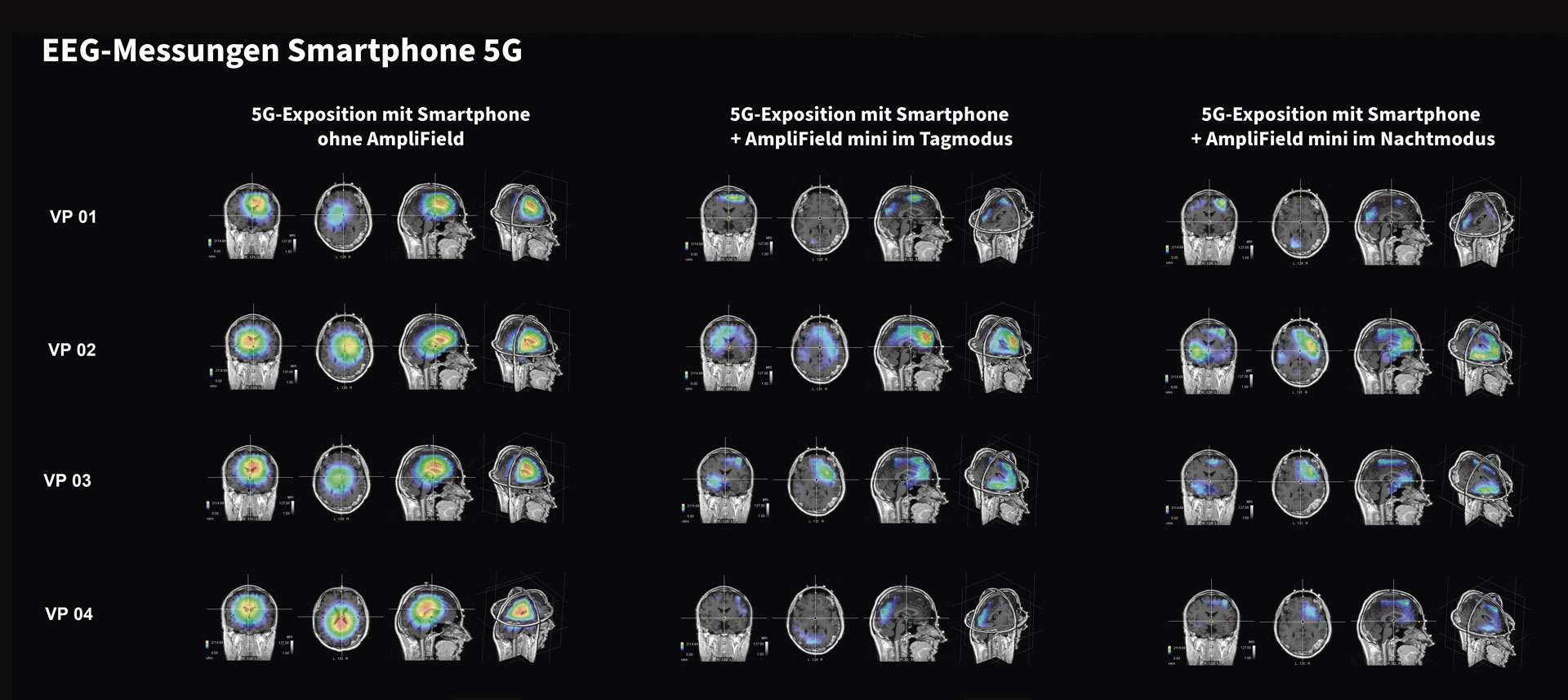 EEG-Messungen Smartphone 5G AmpliField mini
